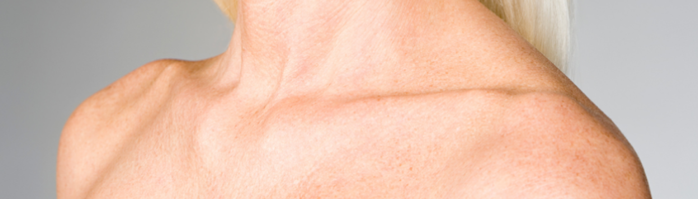 5 Ways to Prevent or Treat Neck & Chest Wrinkles